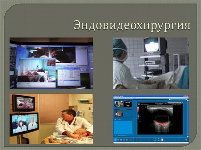 Эндовидеохирургия